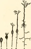 An illustration from Suggestion and psychotherapy (1912)