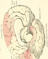 An illustration from Suggestion and psychotherapy (1912)