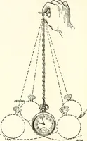 An illustration from Suggestion and psychotherapy (1912)