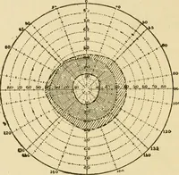 An illustration from Suggestive therapeutics : a treatise on the nature and uses of hypnotism (1889)