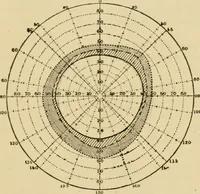 An illustration from Suggestive therapeutics : a treatise on the nature and uses of hypnotism (1889)