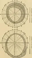 Picture 4 of 9 from Suggestive therapeutics : a treatise on the nature and uses of hypnotism (1889), leaf 288