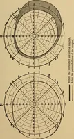 An illustration from Suggestive therapeutics : a treatise on the nature and uses of hypnotism (1880)