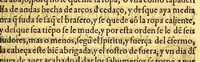 An illustration from Summa y recopilacion de cirugia, con un arte para sangrar, y examen de barberos, (1595)