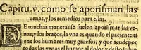 An illustration from Summa y recopilacion de cirugia, con un arte para sangrar, y examen de barberos, (1595)