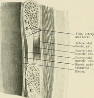An illustration from Surgery of the lung (1913)