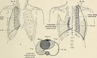 An illustration from Surgery of the lung (1913)