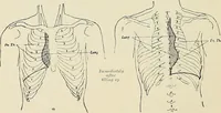 An illustration from Surgery of the lung (1913)
