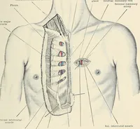 An illustration from Surgery of the lung (1913)