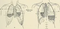 An illustration from Surgery of the lung (1913)