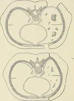 An illustration from Surgery of the lung (1913)