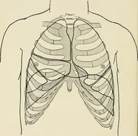 An illustration from Surgery of the lung (1913)