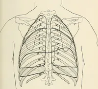 An illustration from Surgery of the lung (1913)
