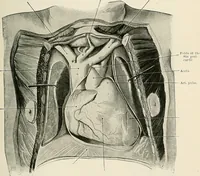 An illustration from Surgery of the lung (1913)