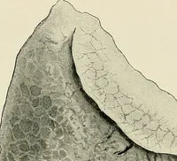 An illustration from Surgery of the lung (1913)