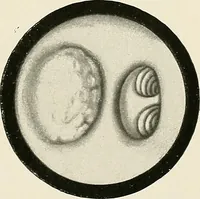 An illustration from Surgery of the lung (1913)