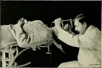 An illustration from Surgery of the lung (1913)