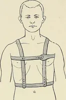 An illustration from Surgery of the lung (1913)