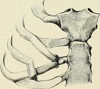 An illustration from Surgery of the lung (1913)