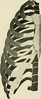 An illustration from Surgery of the lung (1913)