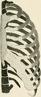 An illustration from Surgery of the lung (1913)