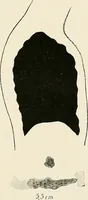 An illustration from Surgery of the lung (1913)