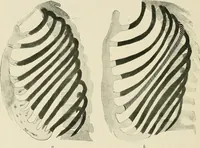 An illustration from Surgery of the lung (1913)