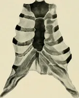An illustration from Surgery of the lung (1913)