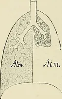 An illustration from Surgery of the lung (1913)
