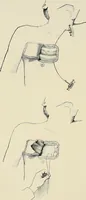 An illustration from Surgery of the lung (1913)