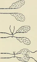 An illustration from Surgery of the lung (1913)