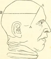 An illustration from A system of phrenology (1835)