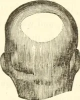 An illustration from A system of phrenology (1835)
