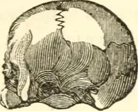 An illustration from A system of phrenology (1835)
