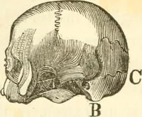 An illustration from A system of phrenology (1835)