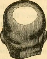 An illustration from A system of phrenology (1830)