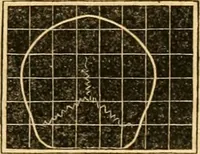 Picture 18 of 35 from A system of phrenology (1830), leaf 198