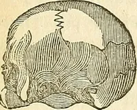 An illustration from A system of phrenology (1839)