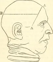 An illustration from A system of phrenology (1839)