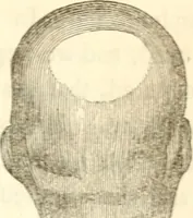 An illustration from A system of phrenology (1839)