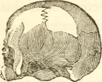 An illustration from A system of phrenology (1839)