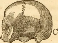 An illustration from A system of phrenology (1839)