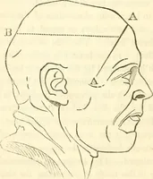 An illustration from A system of phrenology (1839)