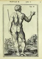 An illustration from Tabulae anatomicae LXXIIX (1632)