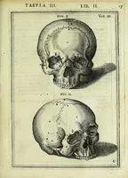 Picture 5 of 63 from Tabulae anatomicae LXXIIX (1632), leaf 23