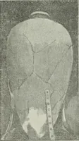 An illustration from Talmudische Archäologie (1910)