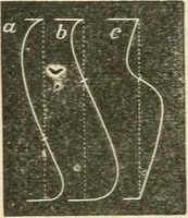An illustration from Teacher's manual for freehand drawing in intermediate schools (1876)