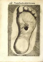 Picture 16 of 19 from Teatro serafico delle stimmate di Christo, impresse nel santo, immaculato, e virginal corpo del glorioso padre san Francesco (1629), leaf 290