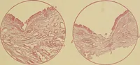 An illustration from A text-book of diseases of the nose and throat (1904)
