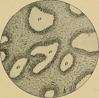 An illustration from A text-book of diseases of the nose and throat (1904)